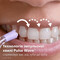 Фото - Іригатор Philips Sonicare Cordless Power Flosser 3000 HX3826/33 | click.ua