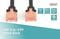 Фото - Патч-корд Digitus CAT 6 UTP, 0.25м, AWG 26/7, Cu, LSZH, чорний (DK-1617-0025/BL) | click.ua
