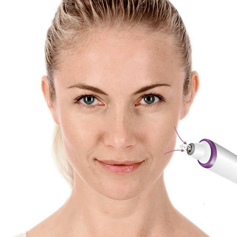 Апарат для мікродермабразії Beurer FC 76